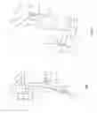 Fig. 03 - Orthopedic device for treating complications of the hip
