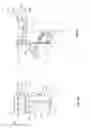Fig. 07 - Orthopedic device for treating complications of the hip