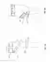 Fig. 08 - Orthopedic device for treating complications of the hip