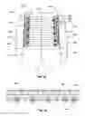 Fig. 11 - Orthopedic device for treating complications of the hip