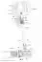 Fig. 25 - Orthopedic device for treating complications of the hip