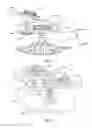 Fig. 27 - Orthopedic device for treating complications of the hip