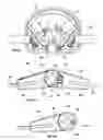 Fig. 32 - Orthopedic device for treating complications of the hip
