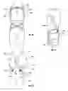 Fig. 36 - Orthopedic device for treating complications of the hip