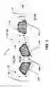 Fig. 04 - PATIENT TREATMENT SYSTEM