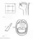Fig. 02 - Tissue crosslinking for treatment of snoring and obstructive sleep apnea