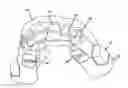 Fig. 01 - Cuspid and first bi-cuspid bite retainer for sleep apnea