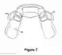 Fig. 06 - Cuspid and first bi-cuspid bite retainer for sleep apnea