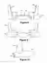 Fig. 07 - Cuspid and first bi-cuspid bite retainer for sleep apnea