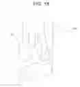 Fig. 16 - Intraocular lens insertion device and intraocular lens insertion system