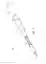 Fig. 11 - Systems, methods, and devices for cannula insertion