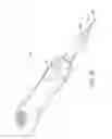 Fig. 12 - Systems, methods, and devices for cannula insertion