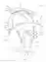Fig. 02 - Ear-engaging and eye-covering head assembly
