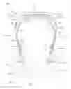 Fig. 10 - Ear-engaging and eye-covering head assembly