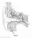 Fig. 03 - Optical microphone for implantable hearing instrument