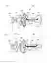 Fig. 04 - EARPLUG AND PUMPING SYSTEMS