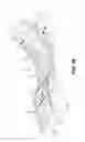 Fig. 31 - Adjustable support device adjustable by an electric motor