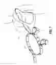 Fig. 06 - GAIT BELT