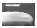 Fig. 01 - Xylitol containing comestible product