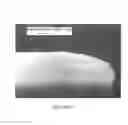Fig. 07 - Xylitol containing comestible product