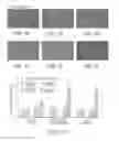 Fig. 08 - Low density lipoprotein nanocarriers for targeted delivery of omega-3 polyunsaturated fatty acids to cancer