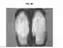 Fig. 06 - Hard capsule formulation
