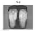 Fig. 07 - Hard capsule formulation