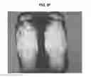 Fig. 08 - Hard capsule formulation