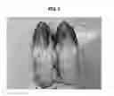 Fig. 09 - Hard capsule formulation