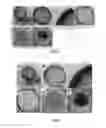 Fig. 14 - HOLLOW NANOPARTICLES WITH HYBRID DOUBLE LAYERS