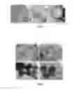 Fig. 17 - HOLLOW NANOPARTICLES WITH HYBRID DOUBLE LAYERS