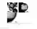Fig. 25 - HOLLOW NANOPARTICLES WITH HYBRID DOUBLE LAYERS