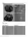 Fig. 02 - COMPOSITION FOR REGENERATING NORMAL TISSUE FROM FIBROTIC TISSUE