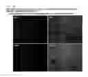 Fig. 04 - COMPOSITION FOR REGENERATING NORMAL TISSUE FROM FIBROTIC TISSUE