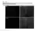 Fig. 09 - COMPOSITION FOR REGENERATING NORMAL TISSUE FROM FIBROTIC TISSUE