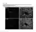 Fig. 10 - COMPOSITION FOR REGENERATING NORMAL TISSUE FROM FIBROTIC TISSUE