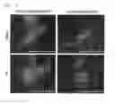 Fig. 12 - COMPOSITION FOR REGENERATING NORMAL TISSUE FROM FIBROTIC TISSUE