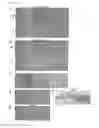 Fig. 16 - COMPOSITION FOR REGENERATING NORMAL TISSUE FROM FIBROTIC TISSUE