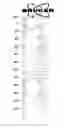 Fig. 09 - COMPOUND, 1, 3-DIOLEIN-2-LINOLEIN, AND PHARMACEUTICAL PREPARATION AND USE THEREOF