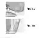 Fig. 04 - Microbicidal composition comprising an octoxynol and a quinolizidine alkaloid compound or a source thereof