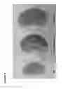 Fig. 07 - Methods of Treating Acute Kidney Injury