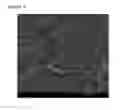 Fig. 05 - NANO- MICRODELIVERY SYSTEMS FOR OROMUCOSAL DELIVERY OF AN ACTIVE INGREDIENT
