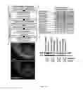 Fig. 03 - Method of promoting remyelination