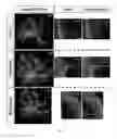 Fig. 10 - Method of promoting remyelination