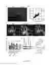 Fig. 16 - Method of promoting remyelination