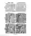 Fig. 23 - Method of promoting remyelination