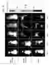 Fig. 11 - Methods of Treating Multiple Myeloma and Resistant Cancers