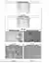 Fig. 10 - Oil-in-water method for making polymeric implants containing a hypotensive lipid