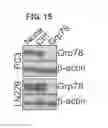 Fig. 25 - METHODS OF CONTROLLING TUMOR BIOENERGETICS NETWORKS