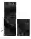 Fig. 08 - Use of nano metal in promoting neurite outgrowth and treatment and/or prevention of neurological disorders